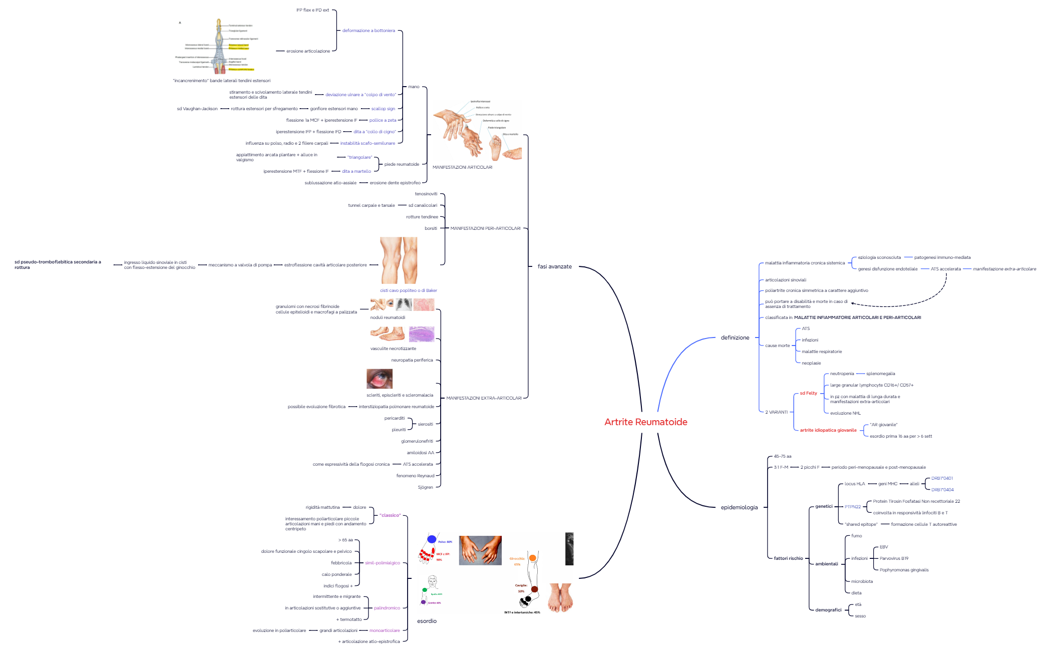 2. Artrite reumatoide preview 1