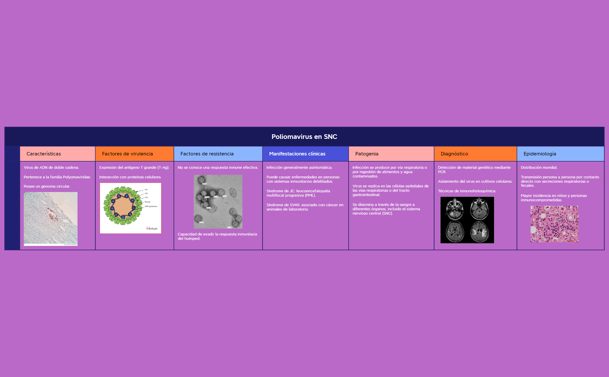 Poliomavirus en SNC preview 1