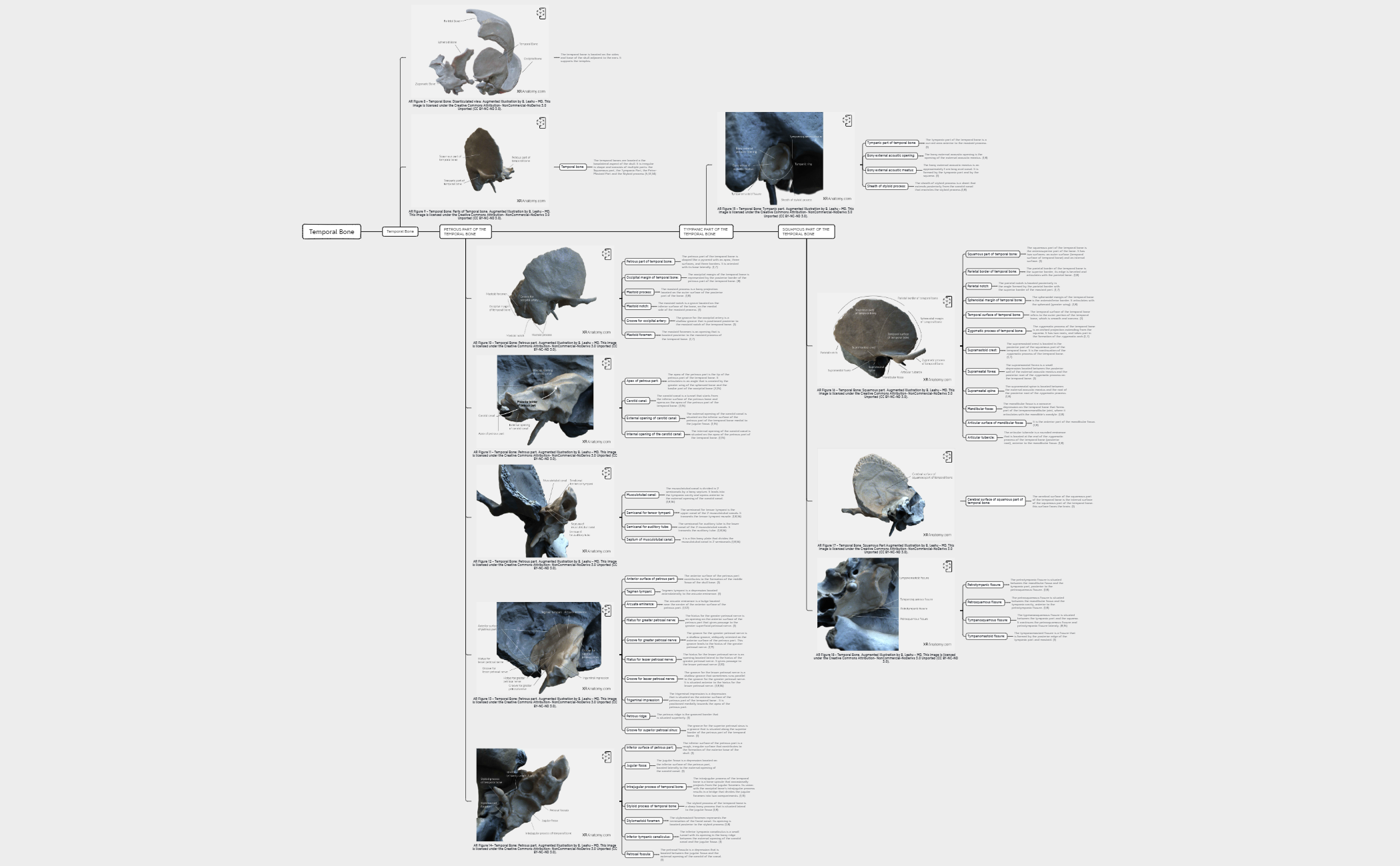 Temporal Bone preview 1