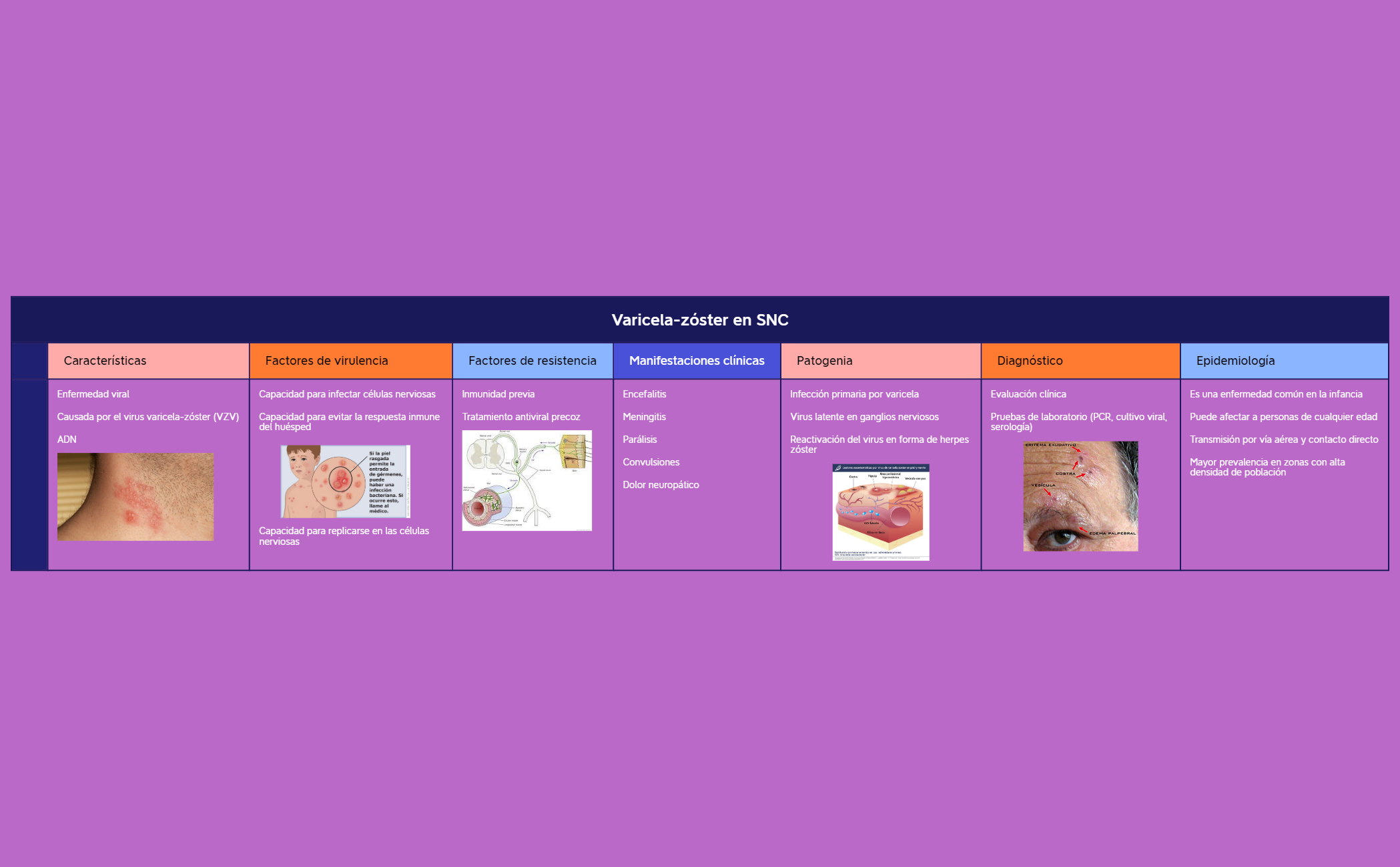 Varicela-zóster en SNC preview 1