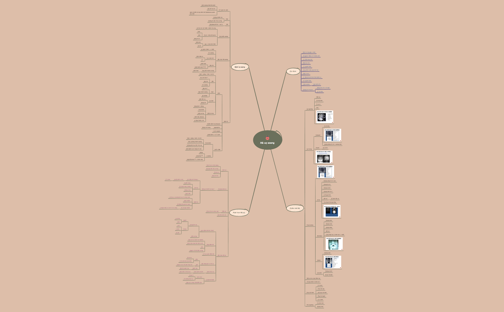 XQ-sọ-xoang.xmind - XMind Template