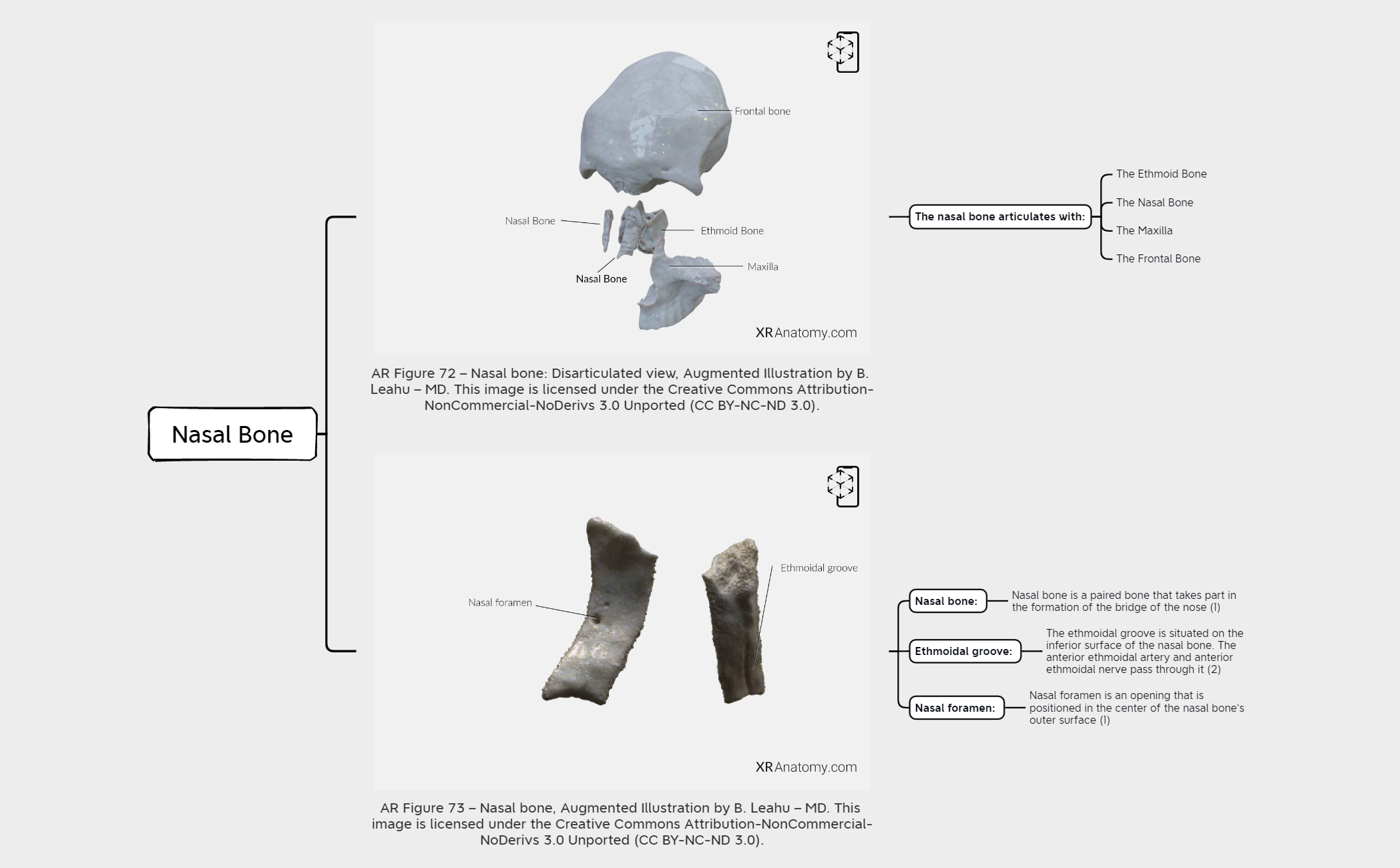 Nasal Bone preview 1