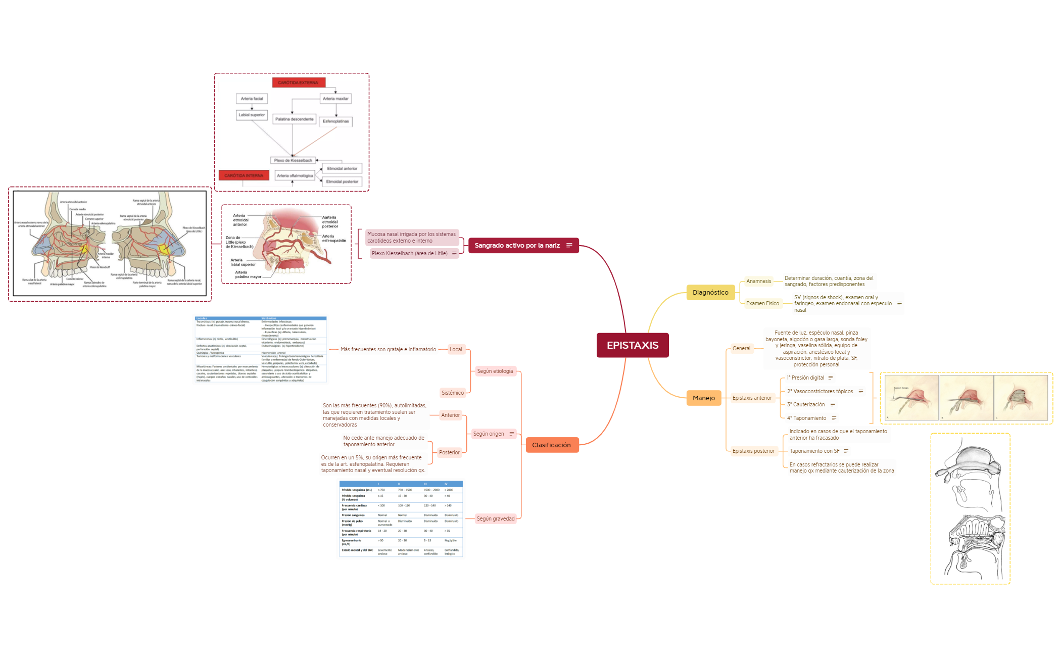 EPISTAXIS.xmind preview 1