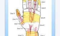 delayed flexor tendon injuries