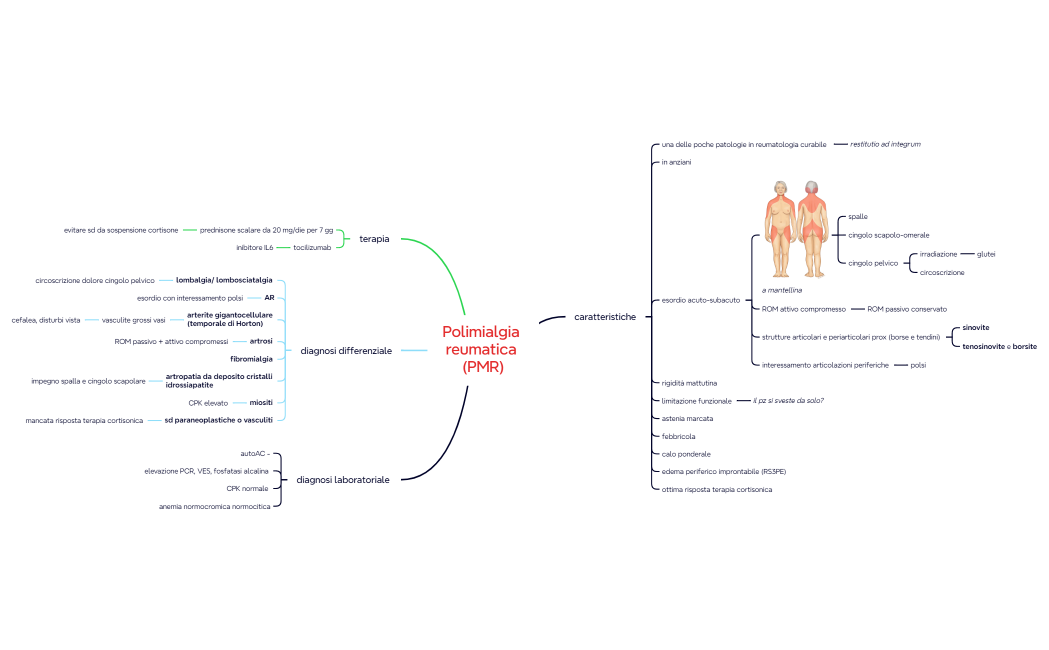 Polimialgia reumatica 