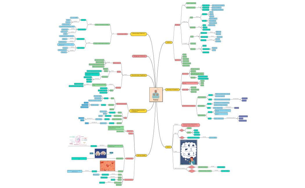 Tremor_10656FfCQspZB3TdR558273-7J8EEQ-1AydsLY-09509