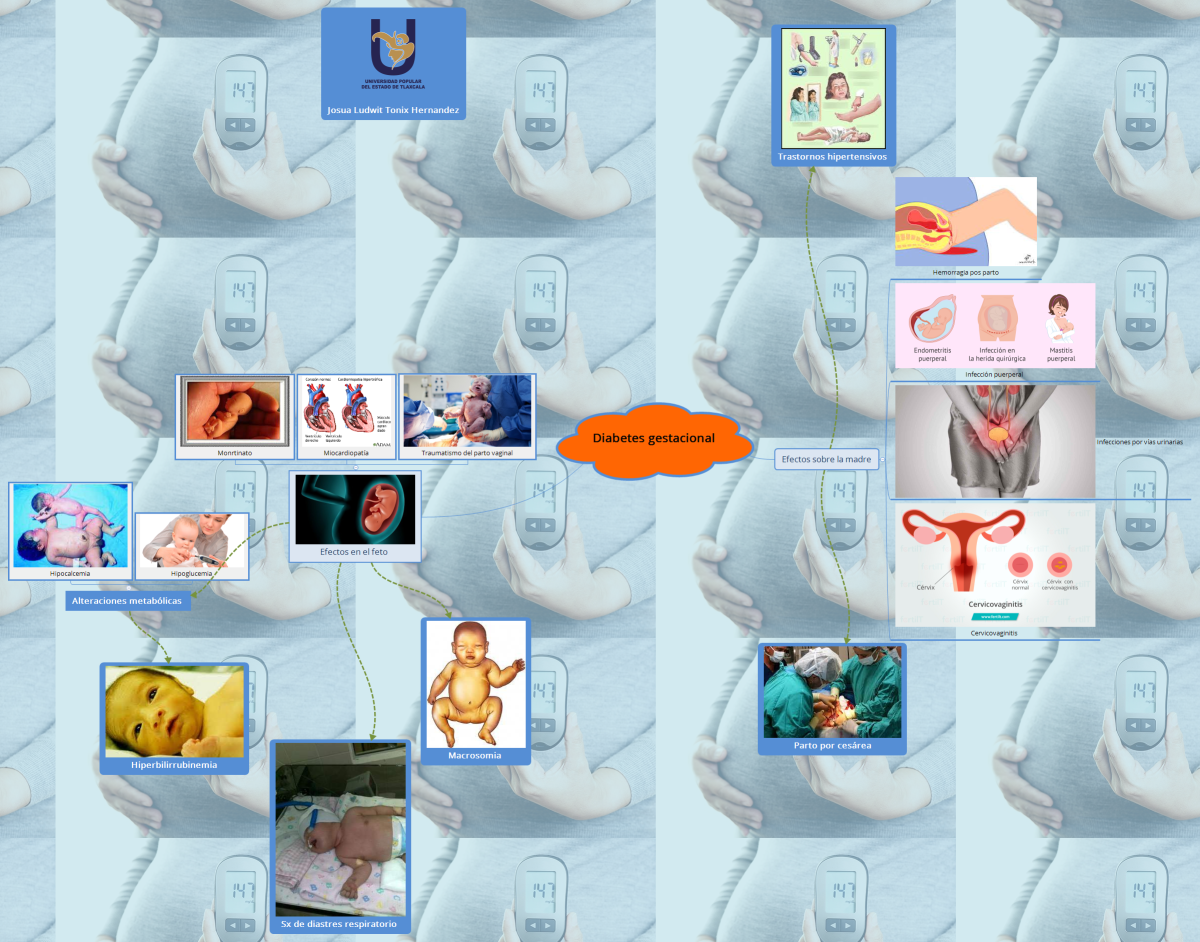 Diabetes gestacional 