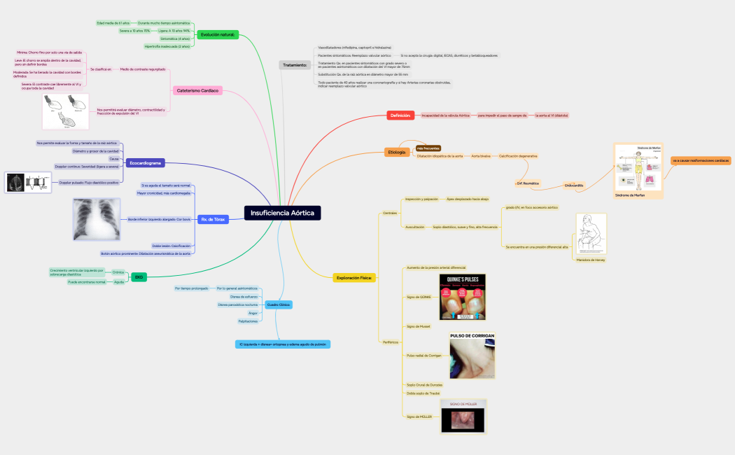 Insuficiencia Aórtica