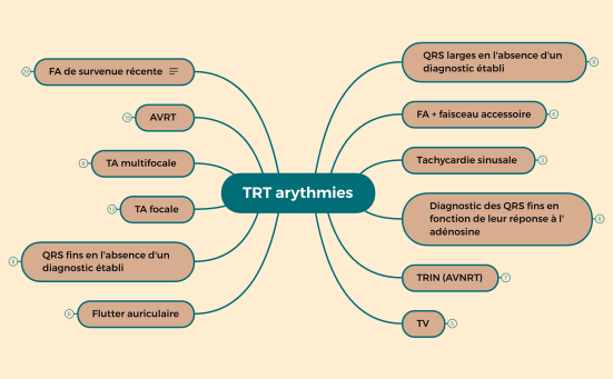 TRT arythmies