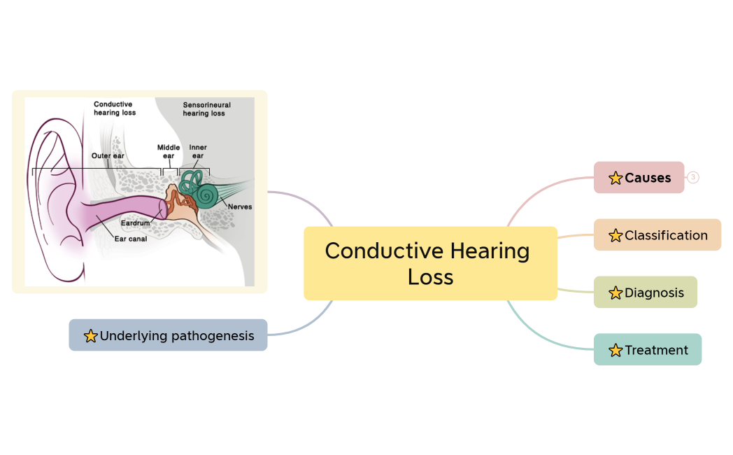 Conductive Hearing Loss