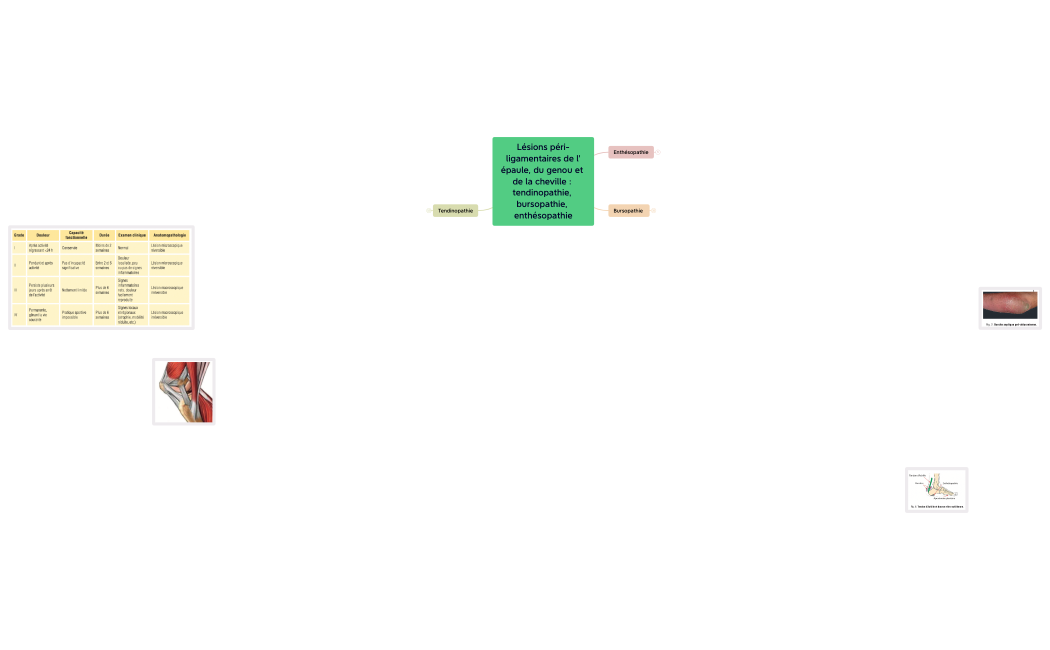 Lésions péri-ligamentaires de l'épaule, du genou et de la cheville : tendinopathie, bursopathie, enthésopathie.xmind