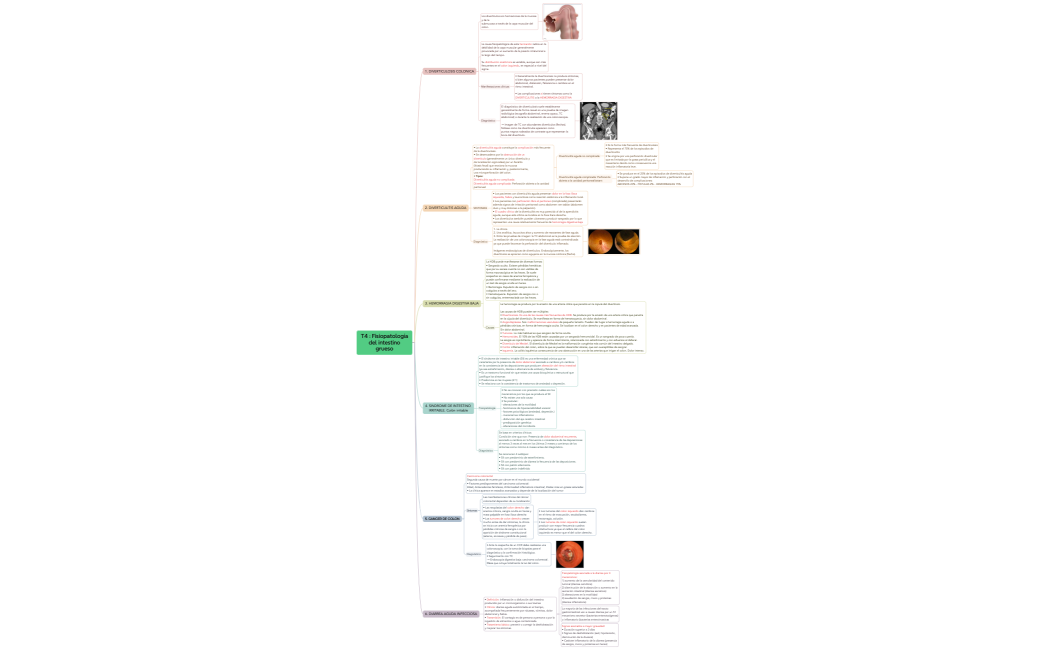 T4  Fisiopatologíadel intestinogrueso