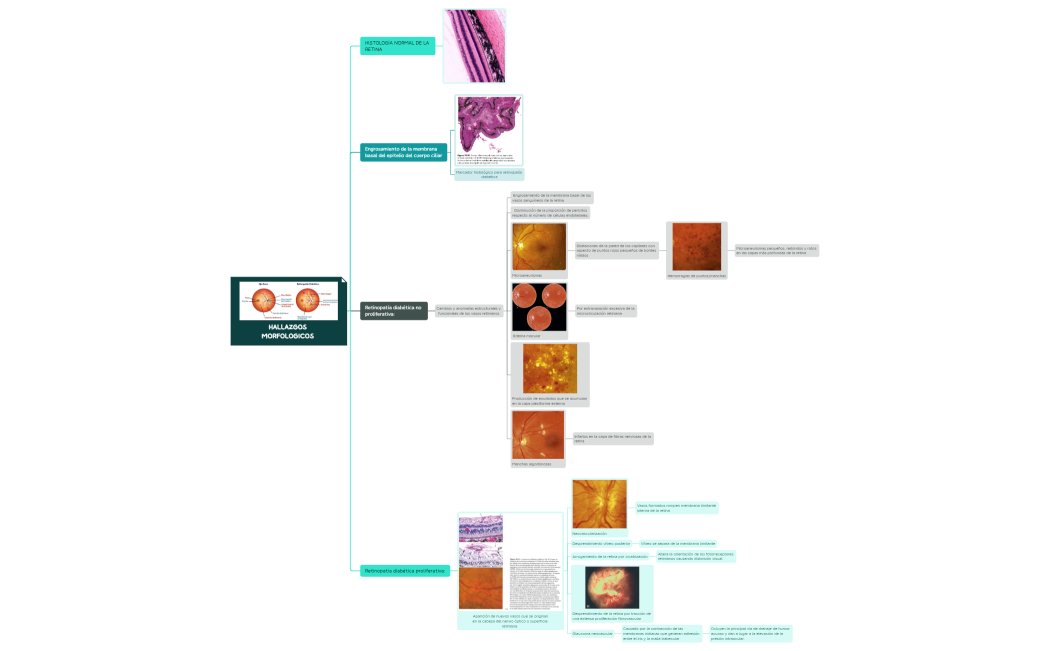 Retinopatía diabética hallazgos.xmind