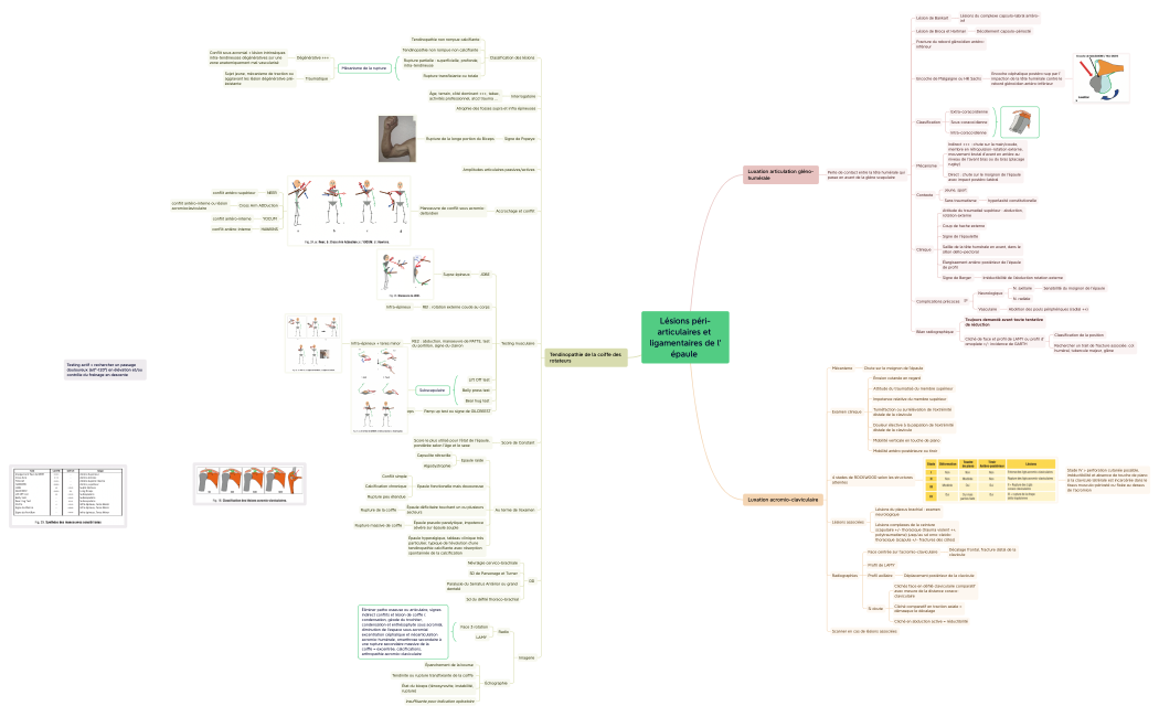 Lésions péri-articulaires et ligamentaires de l'épaule .xmind