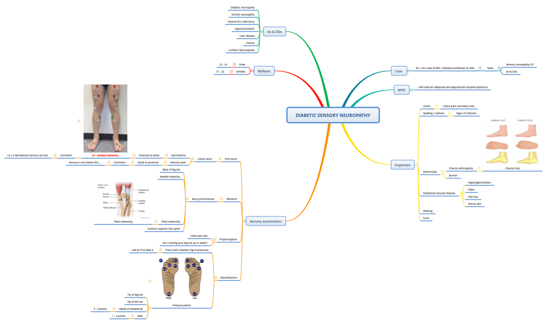 DIABETIC SENSORY NEUROPATHY