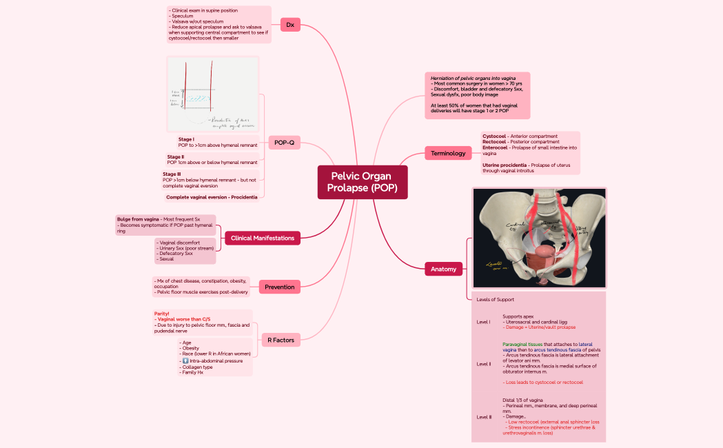 Pelvic Organ Prolapse (POP)