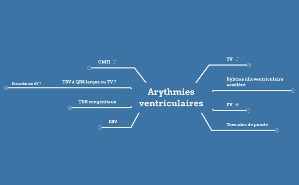 Arythmies ventriculaires 